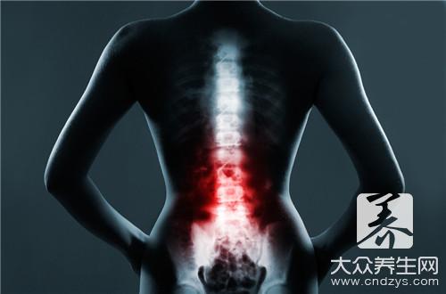 腰椎間盤突出飲食注意事項：忌口食物與護腎建議