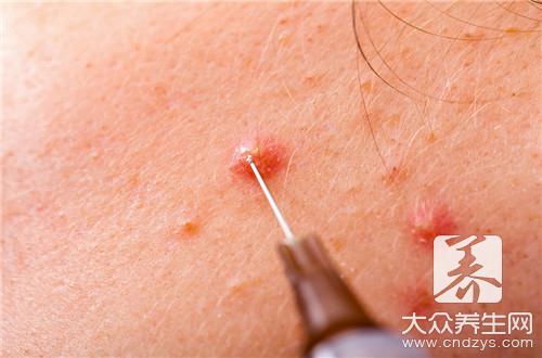 乳腺結節飲食注意事項：哪些食物應避免