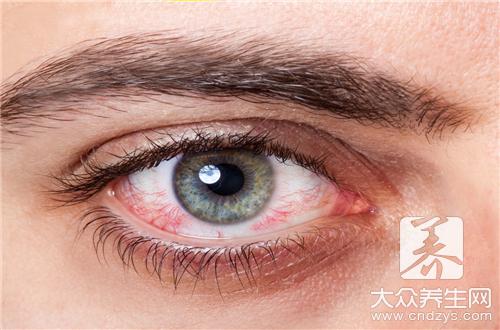 9類人群忌口辣椒:避免引發健康風險